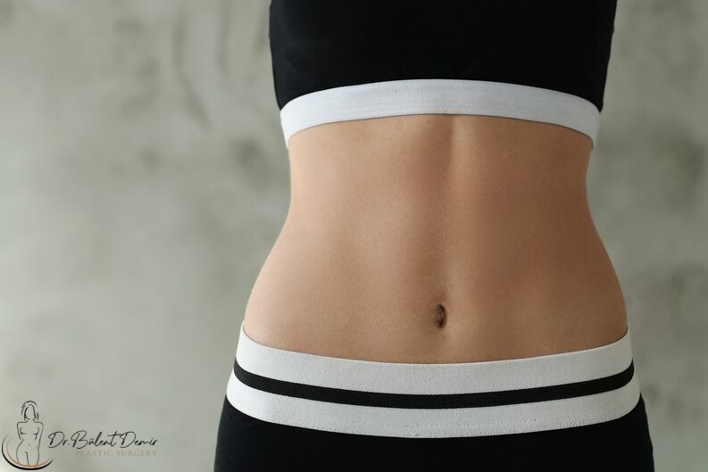 Tummy Tuck (Abdominoplasty) in Antalya,Turkey